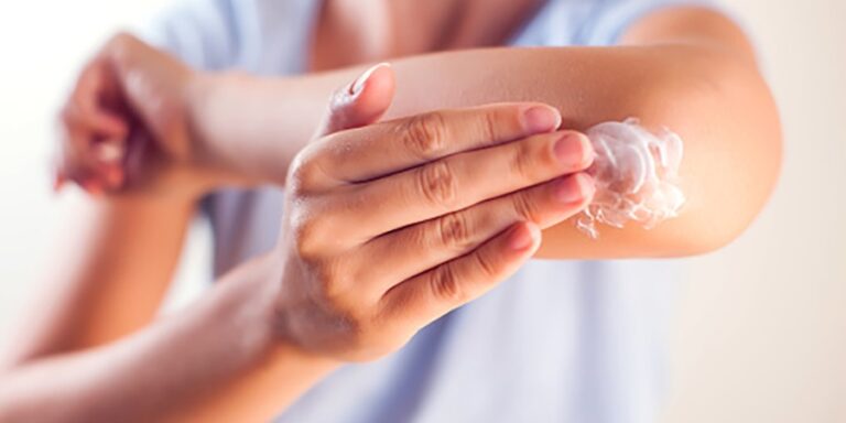 Are Eczema Cures Effective?