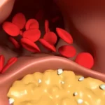 Understanding Importance Good Cholesterol